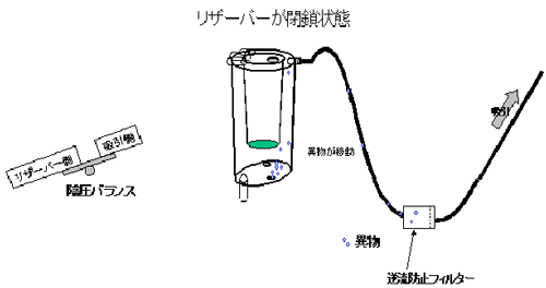 リザーバーが閉鎖状態の図