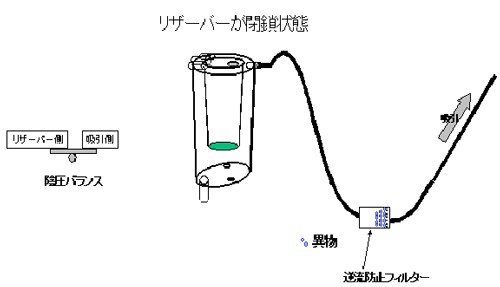 リザーバーが閉鎖状態の図