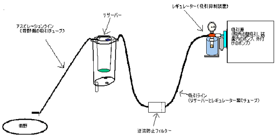 自己血回収セットの構造