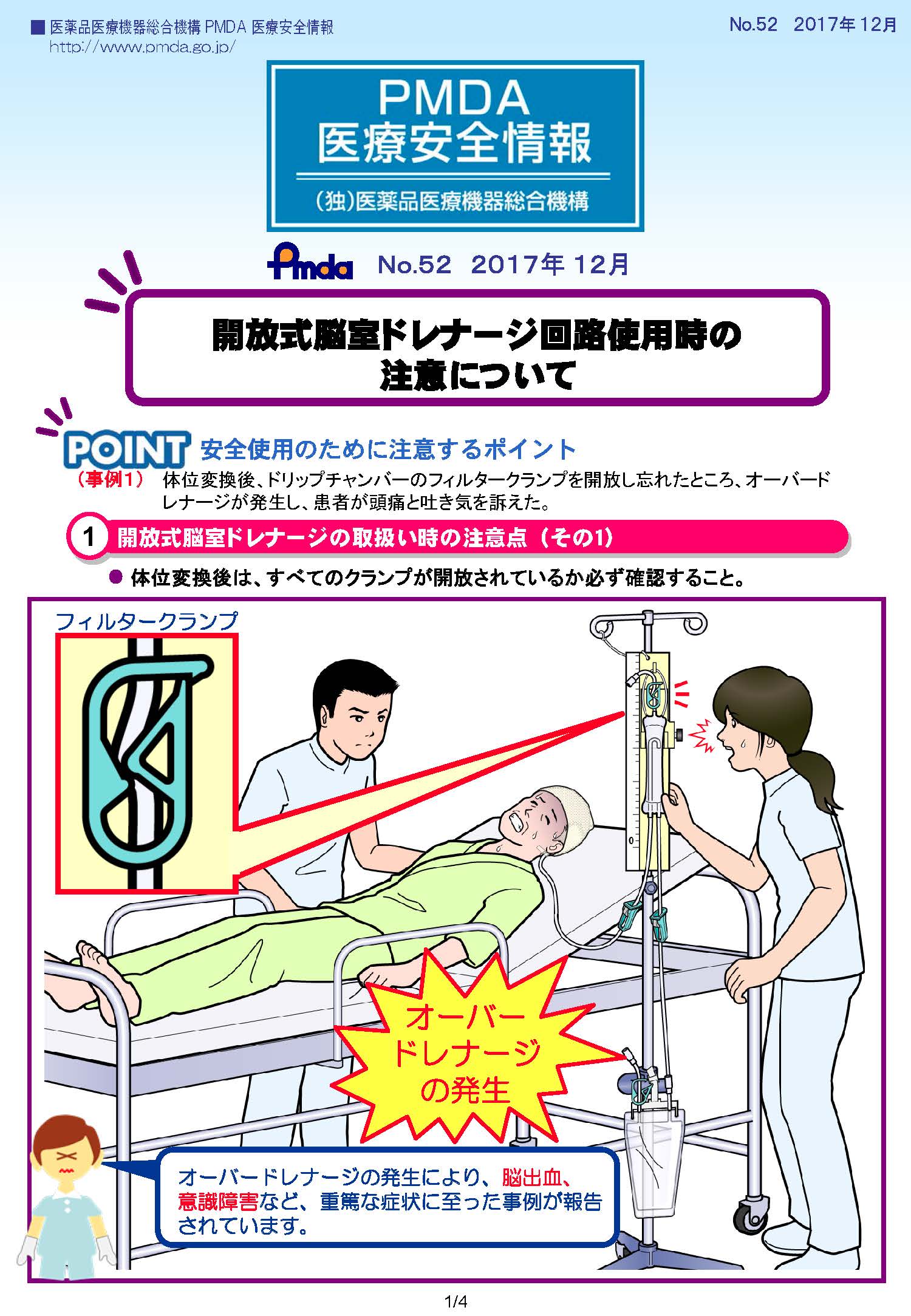 PMDA医療安全情報 No.52 開放式脳室ドレナージ回路使用時の注意について　の1枚目のイメージ画像です。クリックするとPDFファイル（1.33MB）が開きます。