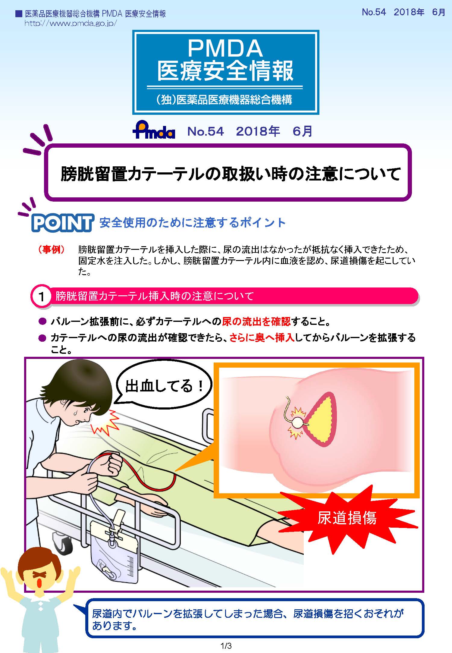 PMDA医療安全情報 No.54　膀胱留置カテーテルの取扱い時の注意について　の1枚目のイメージ画像です。クリックするとPDFファイル（594.55KB）が開きます。