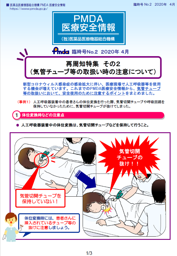 PMDA医療安全情報 臨時号2 再周知特集 その2（気管チューブ等の取扱い時の注意について）　の1枚目のイメージ画像です。クリックするとPDFファイル（1.21MB）が開きます。