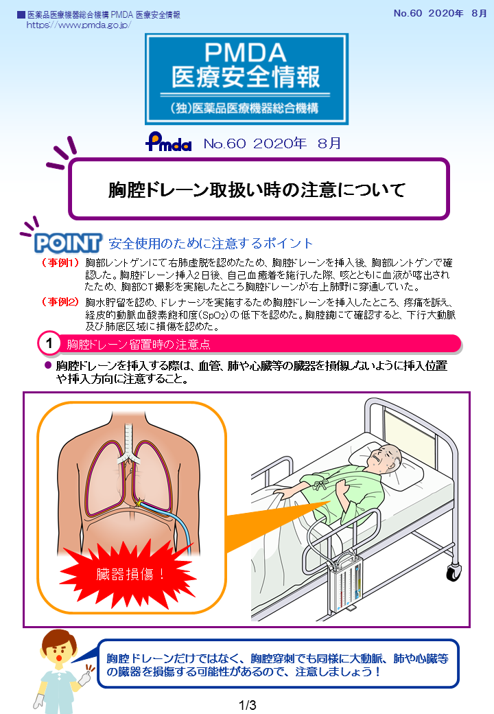 PMDA医療安全情報 No.60 胸腔ドレーン取扱い時の注意について　の1枚目のイメージ画像です。クリックするとPDFファイル（779.98KB）が開きます。