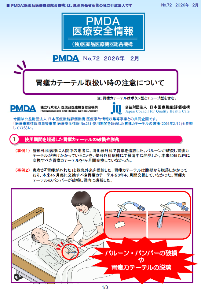 PMDA医療安全情報 No.72 胃瘻カテーテル取扱い時の注意について1枚目のイメージ画像です。クリックするとPDFファイル(1.18MB)が開きます。